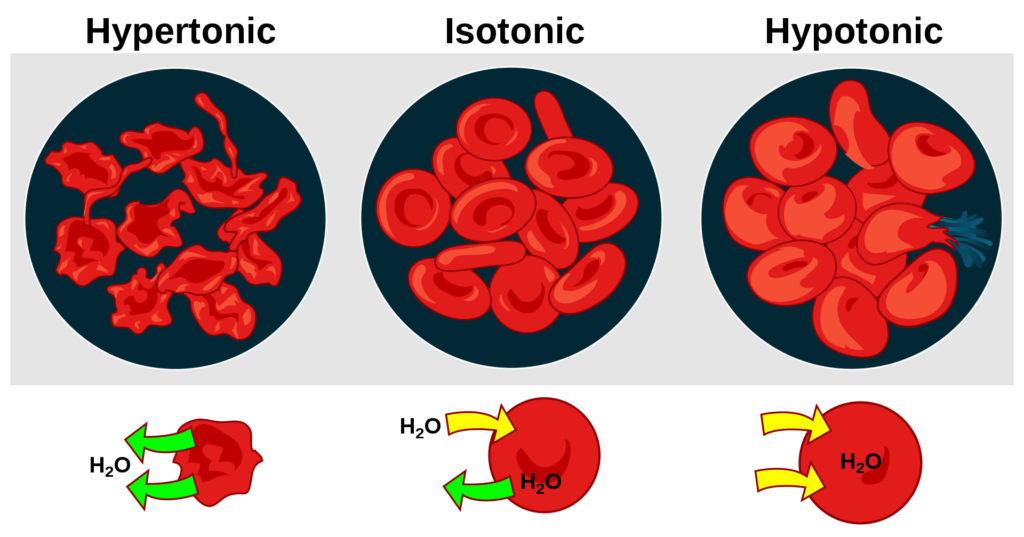 An illustration of the effect of blood cells when placed in solutions of different tonicity